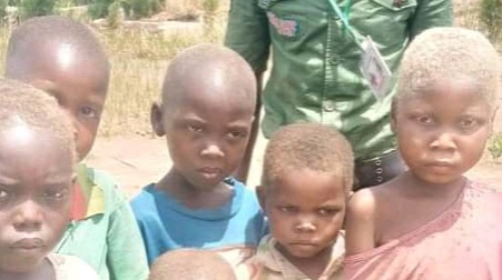 RDC: 533 personnes touchées de malnutrition prises en charge dans le territoire de Dilolo