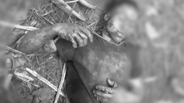 Haut-Katanga : Deux présumés voleurs des câbles snel morts électrocutés à Kipushi